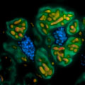 ベータ細菌(緑)の中にガンマ共生細菌(オレンジ)が入り込んだ入れ子状共生系
